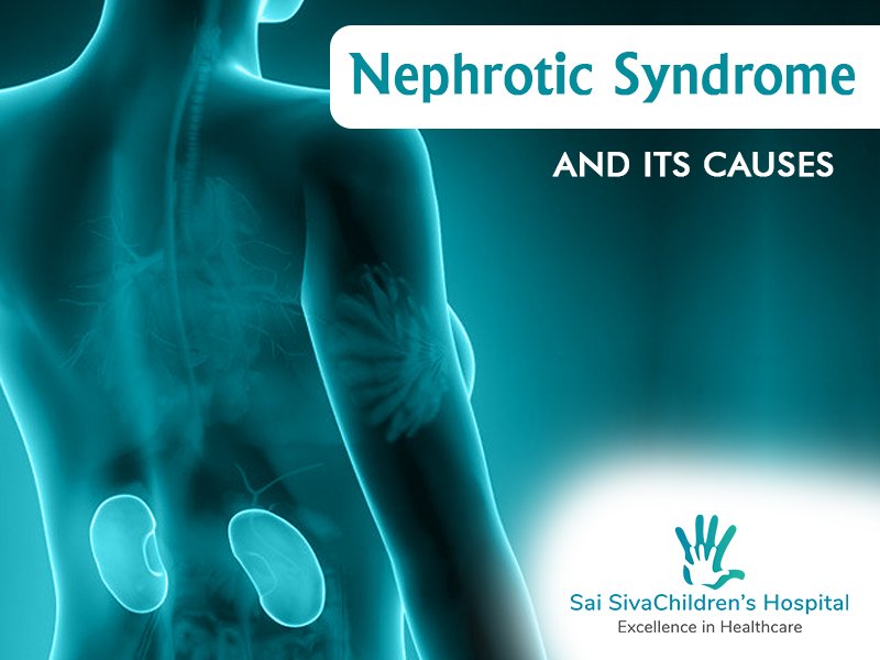 Nephrotic Syndrome And Its Causes
